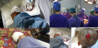Học sinh ngã chấn thương sọ não vì bị thầy giáo tát