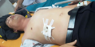 Bị nhắc hình xâm, học sinh đâm thầy giáo thủng gan
