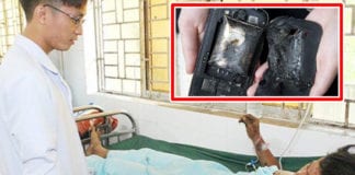 Video Sạc pin, điện thoại nổ, thanh niên ở Đồng Nai phải cắt bỏ bàn tay