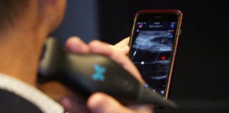 Máy siêu âm cầm tay giúp tự chẩn đoán ung thư
