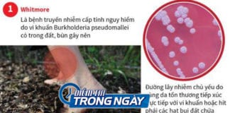 Video Điểm tin: Ba chị em ruột tử vong vì vi khuẩn “ăn thịt người