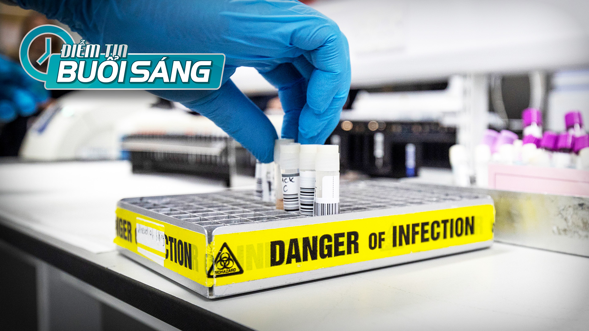 COVID-19 có thể lây lan 1 đến 3 ngày trước khi thấy triệu chứng bệnh