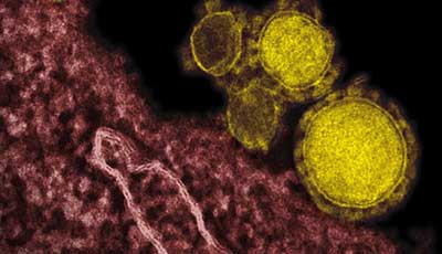 MERS Virus